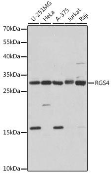 RGS4 Antibody - Western blot analysis of extracts of various cell lines using RGS4 Polyclonal Antibody at dilution of 1:1000.