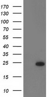 RGS5 Antibody - HEK293T cells were transfected with the pCMV6-ENTRY control (Left lane) or pCMV6-ENTRY RGS5 (Right lane) cDNA for 48 hrs and lysed. Equivalent amounts of cell lysates (5 ug per lane) were separated by SDS-PAGE and immunoblotted with anti-RGS5.