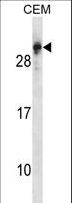 RGS5 Antibody - RGS5 Antibody western blot of CEM cell line lysates (35 ug/lane). The RGS5 antibody detected the RGS5 protein (arrow).