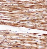 RGS5 Antibody - RGS5 Antibody immunohistochemistry of formalin-fixed and paraffin-embedded human heart tissue followed by peroxidase-conjugated secondary antibody and DAB staining.
