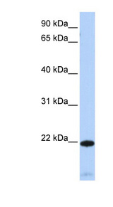 RGS5 Antibody - RGS5 antibody Western blot of Fetal Heart lysate.  This image was taken for the unconjugated form of this product. Other forms have not been tested.