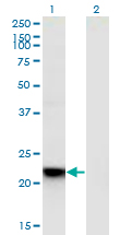 RGS5 Antibody - Western Blot analysis of RGS5 expression in transfected 293T cell line by RGS5 monoclonal antibody (M01), clone 4E12.Lane 1: RGS5 transfected lysate (Predicted MW: 20.9 KDa).Lane 2: Non-transfected lysate.