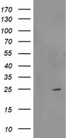 RGS5 Antibody - HEK293T cells were transfected with the pCMV6-ENTRY control (Left lane) or pCMV6-ENTRY RGS5 (Right lane) cDNA for 48 hrs and lysed. Equivalent amounts of cell lysates (5 ug per lane) were separated by SDS-PAGE and immunoblotted with anti-RGS5.