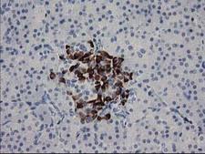 RGS5 Antibody - IHC of paraffin-embedded Human pancreas tissue using anti-RGS5 mouse monoclonal antibody. (Heat-induced epitope retrieval by 10mM citric buffer, pH6.0, 100C for 10min).