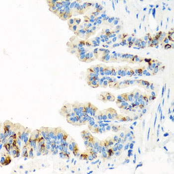 RGS5 Antibody - Immunohistochemistry of paraffin-embedded mouse lung tissue.