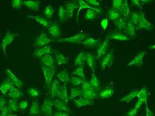 RGS5 Antibody - Immunofluorescence staining of RGS5 in U2OS cells. Cells were fixed with 4% PFA, permeabilzed with 0.1% Triton X-100 in PBS, blocked with 10% serum, and incubated with rabbit anti-Human RGS5 polyclonal antibody (dilution ratio 1:200) at 4°C overnight. Then cells were stained with the Alexa Fluor 488-conjugated Goat Anti-rabbit IgG secondary antibody (green). Positive staining was localized to Cytoplasm.
