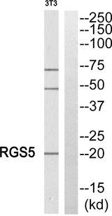 RGS5 Antibody - Western blot analysis of extracts from NIH/3T3 cells, using RGS5 antibody.
