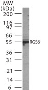 RGS6 Antibody - Western blot of RGS6 in 30 ugs of mouse brain tissue lysate using antibody at 1:1000 dilution.