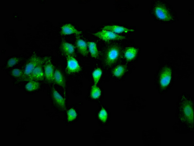 RGS6 Antibody - Immunofluorescence staining of Hela cells at a dilution of 1:100, counter-stained with DAPI. The cells were fixed in 4% formaldehyde, permeabilized using 0.2% Triton X-100 and blocked in 10% normal Goat Serum. The cells were then incubated with the antibody overnight at 4°C.The secondary antibody was Alexa Fluor 488-congugated AffiniPure Goat Anti-Rabbit IgG (H+L) .