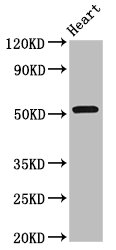 RGS6 Antibody - Positive Western Blot detected in Rat heart tissue. All lanes: RGS6 antibody at 8 µg/ml Secondary Goat polyclonal to rabbit IgG at 1/50000 dilution. Predicted band size: 55, 57, 54, 50, 51, 53, 52, 41, 56 KDa. Observed band size: 55 KDa