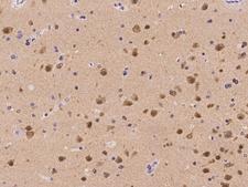 RGS6 Antibody - Immunochemical staining of human RGS6 in human brain with rabbit polyclonal antibody at 1:1000 dilution, formalin-fixed paraffin embedded sections.