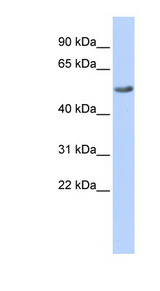 RGS6 Antibody - RGS6 antibody Western blot of Jurkat lysate. This image was taken for the unconjugated form of this product. Other forms have not been tested.
