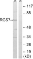 RGS7 Antibody - Western blot analysis of lysates from Jurkat cells, using RGS7 Antibody. The lane on the right is blocked with the synthesized peptide.