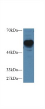 RGS7 Antibody - Western Blot; Sample: Mouse Cerebrum lysate; Primary Ab: 1µg/ml Rabbit Anti-Human RGS7 Antibody Second Ab: 0.2µg/mL HRP-Linked Caprine Anti-Rabbit IgG Polyclonal Antibody