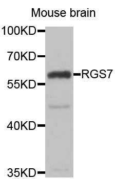 RGS7 Antibody - Western blot analysis of extracts of Mouse brain cells.