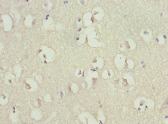 RGS7 Antibody - Immunohistochemistry of paraffin-embedded human brain tissue at dilution 1:100