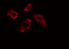 RGS7 Antibody - Staining HeLa cells by IF/ICC. The samples were fixed with PFA and permeabilized in 0.1% Triton X-100, then blocked in 10% serum for 45 min at 25°C. The primary antibody was diluted at 1:200 and incubated with the sample for 1 hour at 37°C. An Alexa Fluor 594 conjugated goat anti-rabbit IgG (H+L) antibody, diluted at 1/600, was used as secondary antibody.