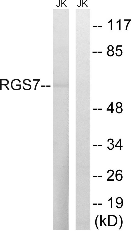RGS7 Antibody - Western blot analysis of extracts from Jurkat cells, using RGS7 antibody.