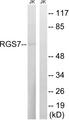 RGS7 Antibody - Western blot analysis of extracts from Jurkat cells, using RGS7 antibody.