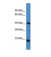 RGS7 Antibody - Western blot of Human Jurkat. RGS7 antibody dilution 1.0 ug/ml.  This image was taken for the unconjugated form of this product. Other forms have not been tested.