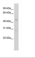 RGS7 Antibody - NIH 3T3 Cell Lysate.  This image was taken for the unconjugated form of this product. Other forms have not been tested.
