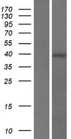 RGS7BP Protein - Western validation with an anti-DDK antibody * L: Control HEK293 lysate R: Over-expression lysate