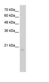 RGS8 Antibody - HepG2 Cell Lysate.  This image was taken for the unconjugated form of this product. Other forms have not been tested.