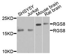 RGS8 Antibody - Western blot analysis of extracts of various cells.