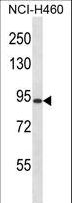 RGS9 Antibody - RGS9 Antibody western blot of NCI-H460 cell line lysates (35 ug/lane). The RGS9 antibody detected the RGS9 protein (arrow).