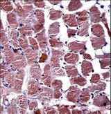 RGS9 Antibody - RGS9 Antibody immunohistochemistry of formalin-fixed and paraffin-embedded human skeletal muscle followed by peroxidase-conjugated secondary antibody and DAB staining.