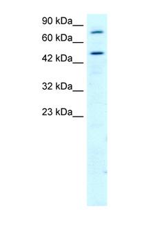 RGS9 Antibody - RGS9 antibody AVARP09024_T100-NP_003826-RGS9 (regulator of G-protein signalling 9) Antibody Western blot of HepG2 Cell lysate. Antibody concentration 1 ug/ml.  This image was taken for the unconjugated form of this product. Other forms have not been tested.