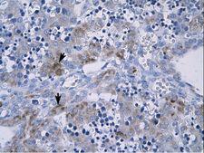 RGS9 Antibody - RGS9 antibody AVARP09024_T100-NP_003826-RGS9 (regulator of G-protein signalling 9) Antibody was used in IHC to stain formalin-fixed, paraffin-embedded human liver.  This image was taken for the unconjugated form of this product. Other forms have not been tested.