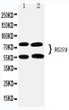 RGS9 Antibody - WB of RGS9 antibody. Lane 1: Rat Brain Tissue Lysate. Lane 2: Mouse Brain Tissue Lysate.