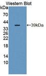 RGS9 Antibody - Western Blot; Sample: Recombinant protein.