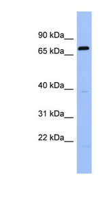 RGS9 Antibody - RGS9 antibody Western blot of Fetal Spleen lysate. This image was taken for the unconjugated form of this product. Other forms have not been tested.