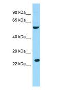 RGS9BP Antibody - RGS9BP antibody Western Blot of HeLa cell lysate.  This image was taken for the unconjugated form of this product. Other forms have not been tested.