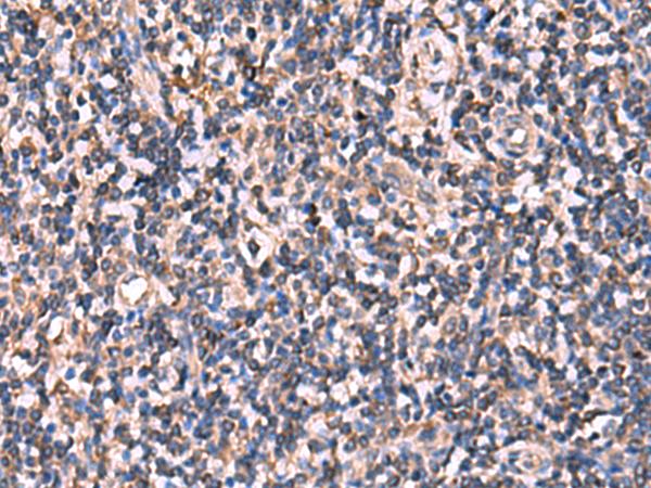 RHAG Antibody - Immunohistochemistry of paraffin-embedded Human tonsil tissue  using RHAG Polyclonal Antibody at dilution of 1:110(×200)