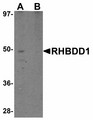 RHBDD1 Antibody - Western blot of RHBDD1 in K562 cell lysate with RHBDD1 antibody at 1 ug/ml in (A) the absence and (B) the presence of blocking peptide.