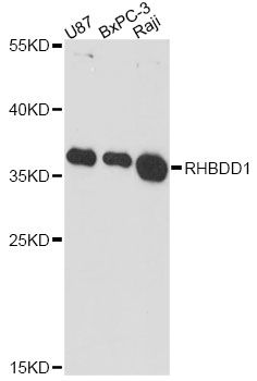 RHBDD1 Antibody - Western blot analysis of extracts of various cell lines, using RHBDD1 antibody at 1:3000 dilution. The secondary antibody used was an HRP Goat Anti-Rabbit IgG (H+L) at 1:10000 dilution. Lysates were loaded 25ug per lane and 3% nonfat dry milk in TBST was used for blocking. An ECL Kit was used for detection and the exposure time was 90s.