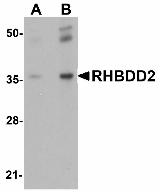 RHBDD2 Antibody - Western blot of RHBDD2 in rat lung tissue lysate with RHBDD2 antibody at (A) 1 and (B) 2 ug/ml.