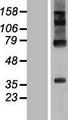 RHBDD2 Protein - Western validation with an anti-DDK antibody * L: Control HEK293 lysate R: Over-expression lysate