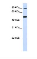RHBDF1 Antibody - 721_B cell lysate. Antibody concentration: 1.0 ug/ml. Gel concentration: 12%.  This image was taken for the unconjugated form of this product. Other forms have not been tested.