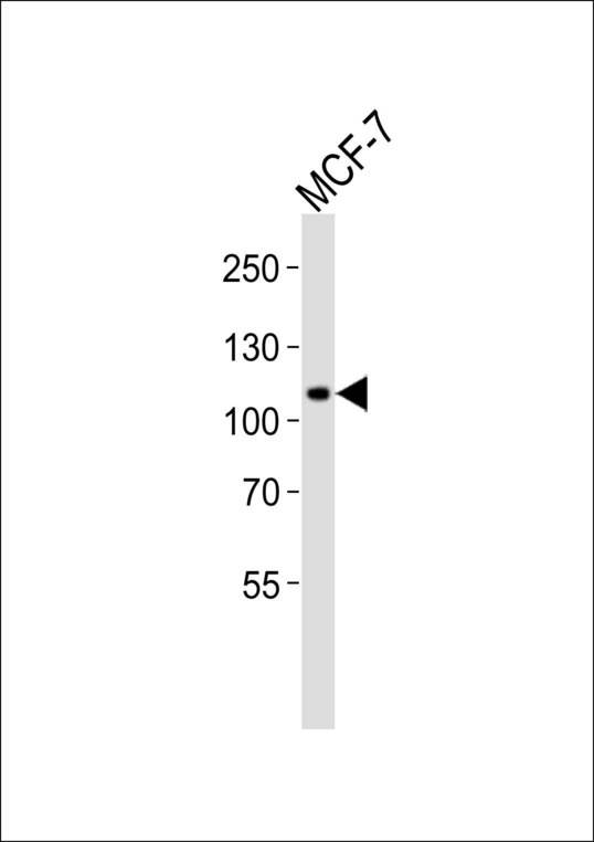 RHBDF2 Antibody - Western blot of lysate from MCF-7 cell line, using RHBDF2 Antibody. Antibody was diluted at 1:1000. A goat anti-rabbit IgG H&L (HRP) at 1:10000 dilution was used as the secondary antibody. Lysate at 20ug.