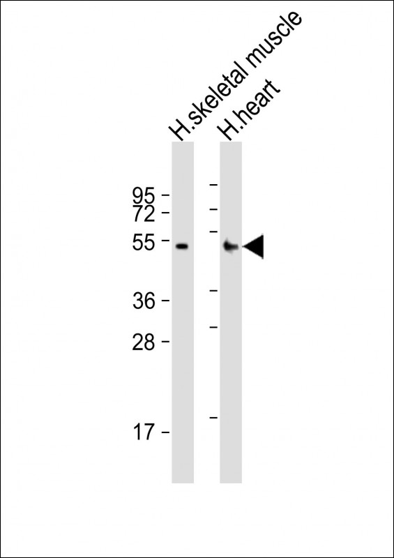 RHBDL1 Antibody - All lanes: Anti-RHBDL1 Antibody (Center) at 1:2000 dilution. Lane 1: human skeletal muscle lysates. Lane 2: human heart lysates Lysates/proteins at 20 ug per lane. Secondary Goat Anti-Rabbit IgG, (H+L), Peroxidase conjugated at 1:10000 dilution. Predicted band size: 48 kDa. Blocking/Dilution buffer: 5% NFDM/TBST.