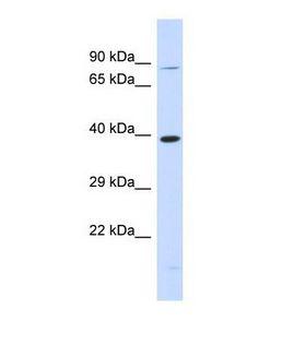 RHBDL2 / RRP2 Antibody - Western blot of Human 293T. RHBDL2 antibody dilution 1.0 ug/ml.  This image was taken for the unconjugated form of this product. Other forms have not been tested.