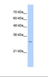 RHBDL2 / RRP2 Antibody - PANC1 cell lysate. Antibody concentration: 1.0 ug/ml. Gel concentration: 12%.  This image was taken for the unconjugated form of this product. Other forms have not been tested.