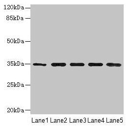 RHBDL2 / RRP2 Antibody - Western blot All lanes: Rhomboid-related protein 2 antibody at 12µg/ml Lane 1: Hela whole cell lysate Lane 2: 293T whole cell lysate Lane 3: A431 whole cell lysate Lane 4: A549 whole cell lysate Lane 5: Mouse brain tissue Secondary Goat polyclonal to rabbit IgG at 1/10000 dilution Predicted band size: 35, 16 kDa Observed band size: 35 kDa