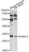 RHBDL2 / RRP2 Antibody - Western blot analysis of extracts of various cell lines, using RHBDL2 antibody at 1:1000 dilution. The secondary antibody used was an HRP Goat Anti-Rabbit IgG (H+L) at 1:10000 dilution. Lysates were loaded 25ug per lane and 3% nonfat dry milk in TBST was used for blocking. An ECL Kit was used for detection and the exposure time was 40s.