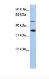 RHBG Antibody - HepG2 cell lysate. Antibody concentration: 1.0 ug/ml. Gel concentration: 12%.  This image was taken for the unconjugated form of this product. Other forms have not been tested.