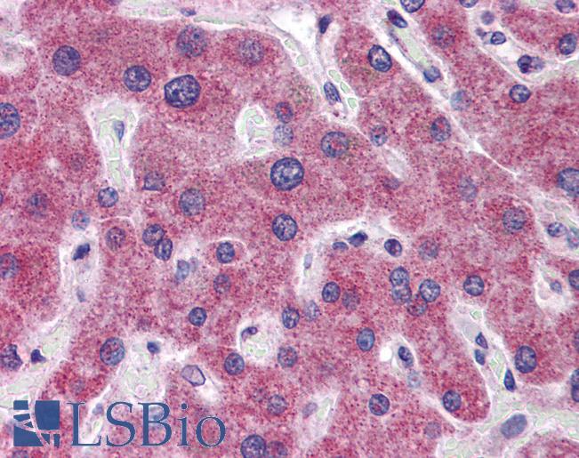 RHBG Antibody - Anti-RHBG antibody IHC of human liver. Immunohistochemistry of formalin-fixed, paraffin-embedded tissue after heat-induced antigen retrieval. Antibody concentration 5 ug/ml.  This image was taken for the unconjugated form of this product. Other forms have not been tested.